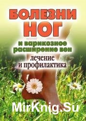 Болезни ног и варикозное расширение вен. Лечение и профилактика