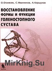 Восстановление формы и функции голеностопного сустава