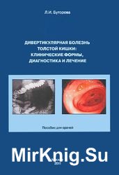 Дивертикулярная болезнь толстой кишки: клинические формы, диагностика и лечение