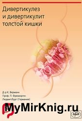 Дивертикулез и дивертикулит толстой кишки