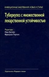 Туберкулез с множественной лекарственной устойчивостью