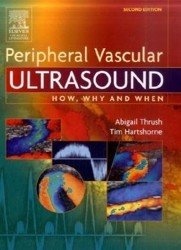 Peripheral vascular ultrasound. How, why, and when